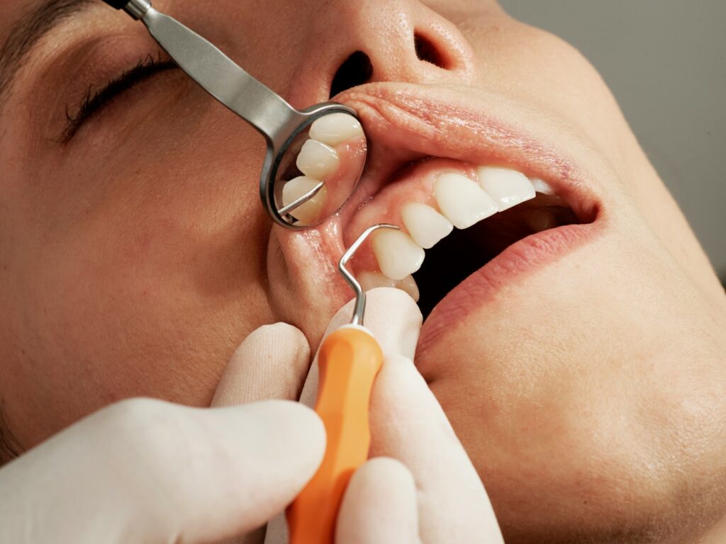 Tandhygienist Stockholm - Professionell Munhygien